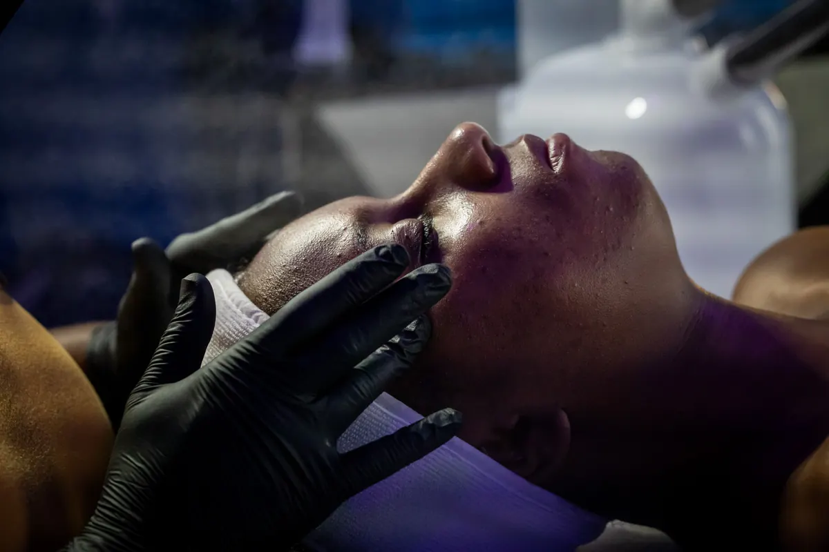 Discover the Benefits of Chemical Peels