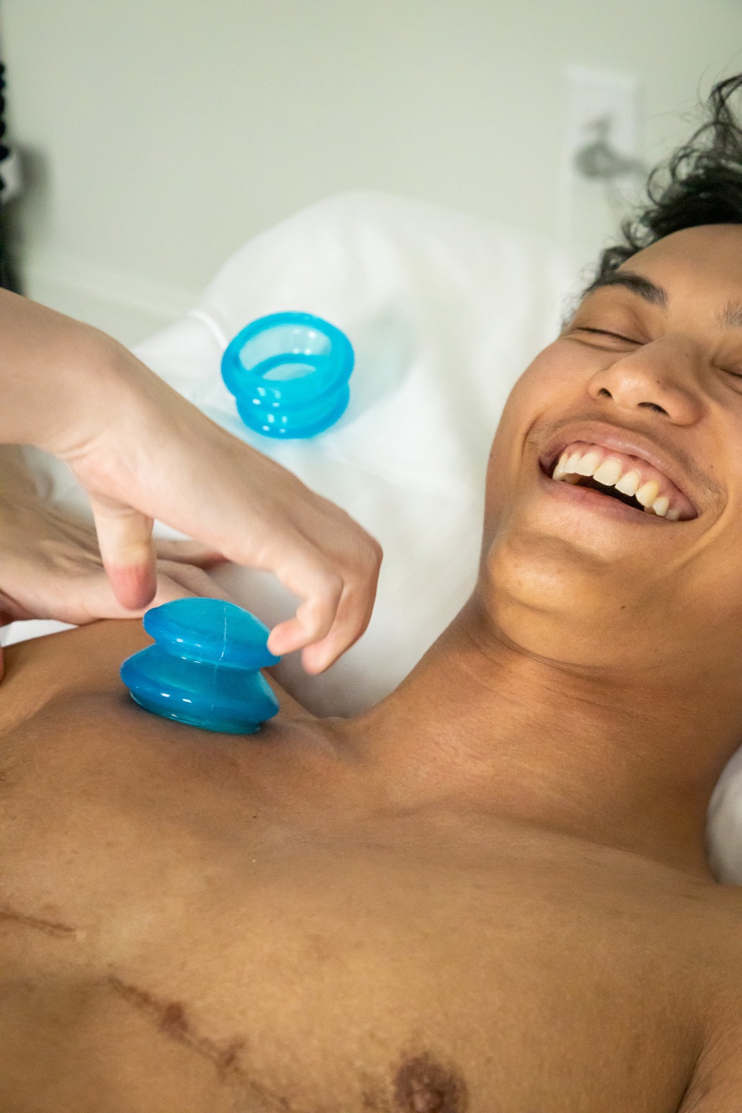 Cupping therapy at Auroraflow